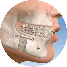 oral-and-maxillofacial-surgery